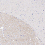 VAChT Antibody in Immunohistochemistry (Paraffin) (IHC (P))