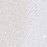 VAChT Antibody in Immunohistochemistry (Paraffin) (IHC (P))