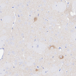 VAChT Antibody in Immunohistochemistry (Paraffin) (IHC (P))