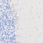 SOX1 Antibody in Immunohistochemistry (Paraffin) (IHC (P))