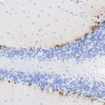 SOX1 Antibody in Immunohistochemistry (Paraffin) (IHC (P))