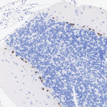 SOX1 Antibody in Immunohistochemistry (Paraffin) (IHC (P))