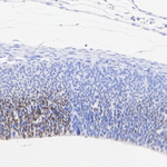 SOX1 Antibody in Immunohistochemistry (Paraffin) (IHC (P))