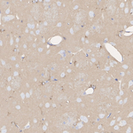 APOE Recombinant Rabbit Monoclonal Antibody (PSH10-52)