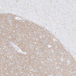 Acetylcholinesterase Recombinant Rabbit Monoclonal Antibody (PSH10-55)