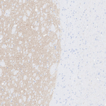 Acetylcholinesterase Antibody in Immunohistochemistry (Paraffin) (IHC (P))
