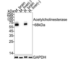 Acetylcholinesterase Antibody in Western Blot (WB)
