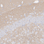 SHANK2 Antibody in Immunohistochemistry (Paraffin) (IHC (P))