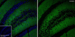 SHANK2 Antibody in Immunohistochemistry (Paraffin) (IHC (P))