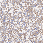 Noggin Recombinant Rabbit Monoclonal Antibody (PSH10-62)