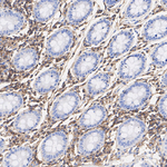 CD48 Antibody in Immunohistochemistry (Paraffin) (IHC (P))