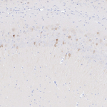 Arg3.1 Recombinant Rabbit Monoclonal Antibody (PSH10-67)