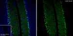 FABP7 Antibody in Immunohistochemistry (Paraffin) (IHC (P))
