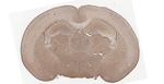 FABP7 Antibody in Immunohistochemistry (Paraffin) (IHC (P))