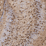 FABP7 Antibody in Immunohistochemistry (Paraffin) (IHC (P))