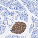 SV2A Antibody in Immunohistochemistry (Paraffin) (IHC (P))