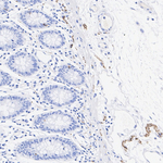 Peripherin Antibody in Immunohistochemistry (Paraffin) (IHC (P))