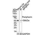 Peripherin Antibody in Western Blot (WB)