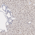 PIN1 Antibody in Immunohistochemistry (Paraffin) (IHC (P))