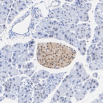 PIN1 Antibody in Immunohistochemistry (Paraffin) (IHC (P))