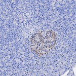 PIN1 Antibody in Immunohistochemistry (Paraffin) (IHC (P))