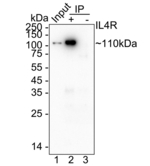 IL4R Antibody in Immunoprecipitation (IP)