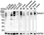 MAGI1 Recombinant Rabbit Monoclonal Antibody (PSH10-91)