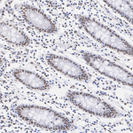 FOXM1 Antibody in Immunohistochemistry (Paraffin) (IHC (P))