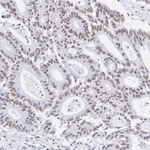 FOXM1 Antibody in Immunohistochemistry (Paraffin) (IHC (P))