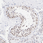 SIRT6 Antibody in Immunohistochemistry (Paraffin) (IHC (P))