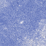 RORA Recombinant Rabbit Monoclonal Antibody (PSH11-00)