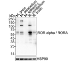RORA Antibody in Western Blot (WB)