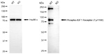 Phospho-IGF1R (Tyr1166) Antibody in Western Blot (WB)