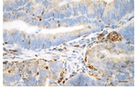 Phospho-Vimentin (Ser72) Antibody in Immunohistochemistry (Paraffin) (IHC (P))