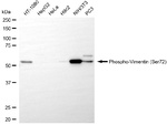 Phospho-Vimentin (Ser72) Antibody in Western Blot (WB)