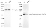 Phospho-Vimentin (Ser72) Antibody in Western Blot (WB)