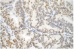 Phospho-Vimentin (Ser56) Antibody in Immunohistochemistry (Paraffin) (IHC (P))