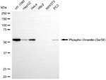 Phospho-Vimentin (Ser56) Antibody in Western Blot (WB)
