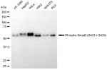 Phospho-SMAD3 (Ser423, Ser425) Antibody in Western Blot (WB)