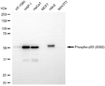 Phospho-p53 (Ser392) Antibody in Western Blot (WB)