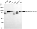 Phospho-MSK1 (Ser376) Antibody in Western Blot (WB)