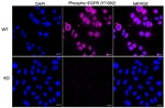 Phospho-EGFR (Tyr1068) Antibody in Immunocytochemistry (ICC/IF)
