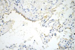 Phospho-EGFR (Tyr1068) Antibody in Immunohistochemistry (Paraffin) (IHC (P))