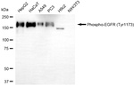 Phospho-EGFR (Tyr1173) Antibody in Western Blot (WB)