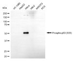 Phospho-p53 (Ser33) Antibody in Western Blot (WB)