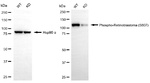 Phospho-Rb (Ser807) Antibody in Western Blot (WB)