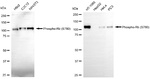 Phospho-Rb (Ser780) Antibody in Western Blot (WB)