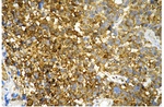 PGK1 Antibody in Immunohistochemistry (Paraffin) (IHC (P))