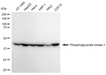 PGK1 Antibody in Western Blot (WB)