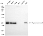 TK1 Antibody in Western Blot (WB)